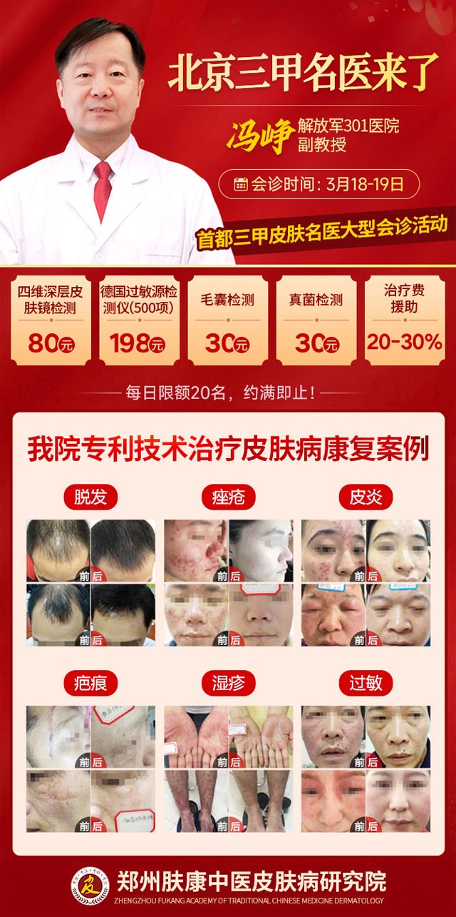 【郑州皮肤医院】特邀北京解放军301医院冯铮副教授坐诊